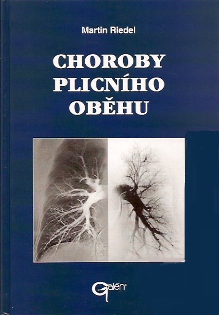 Choroby plicn�ho ob�hu