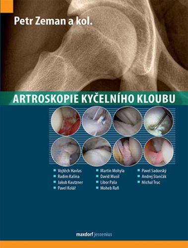 Artroskopie kyelnho kloubu