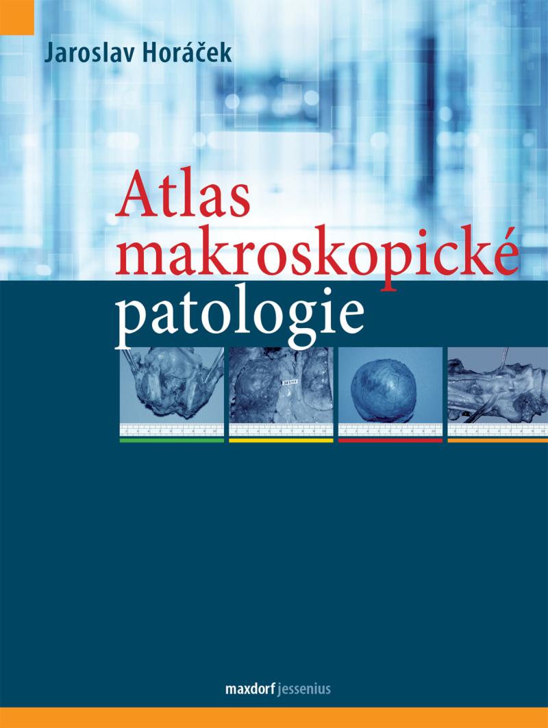 Atlas makroskopick� patologie 