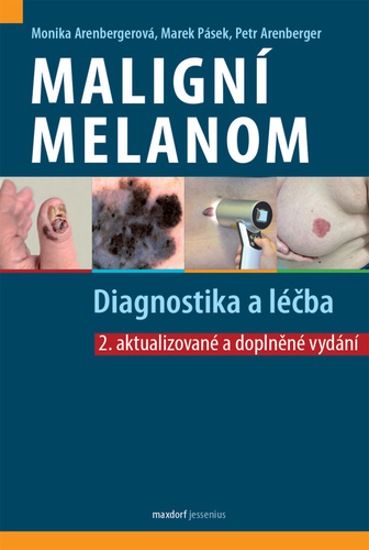 Malign� melanom � Diagnostika a l��ba 