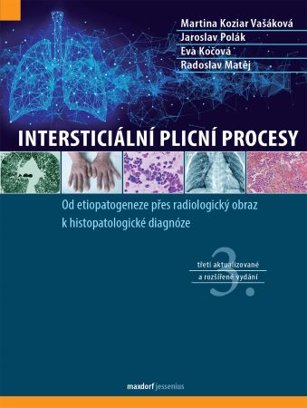 Interstici�ln� plicn� procesy, 3. vyd�n�