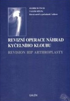 Revizn� operace n�hrad ky�eln�ho kloubu