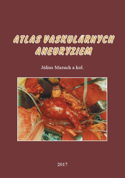 Atlas vaskul�rnych aneuryziem