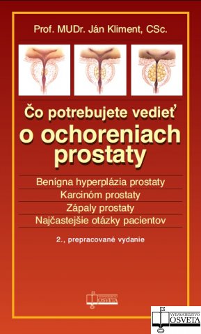 �o potrebujete vedie� o ochreniach prostaty