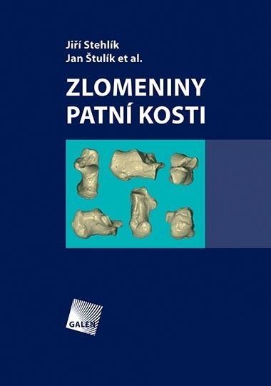 Zlomeniny patn� kosti