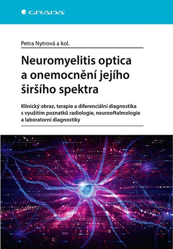 Neuromyelitis optica a poruchy jej�ho �i