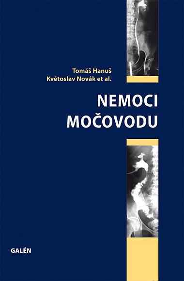 Nemoci mo�ovodu