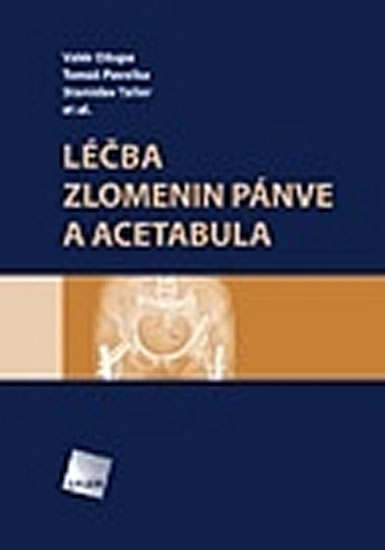 L��ba zlomenin p�nve a acetabula