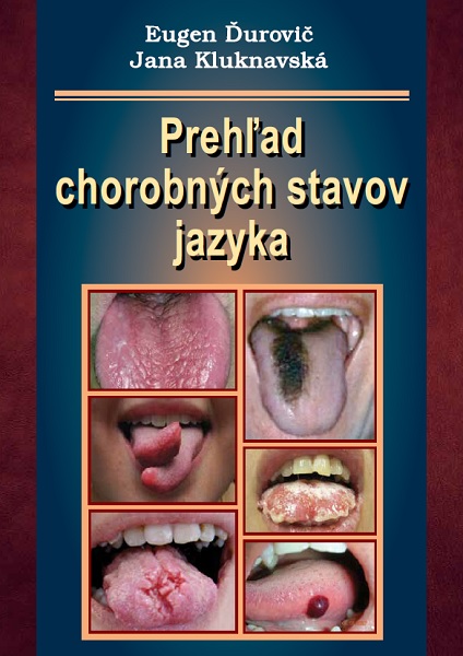 Preh�ad chorobn�ch stavov jazyka