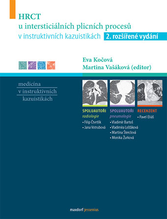 HRCT u interstici�ln�ch plicn�ch proces� v instruktivn�ch kazuistik�ch, 2. roz���en� vyd�n�
